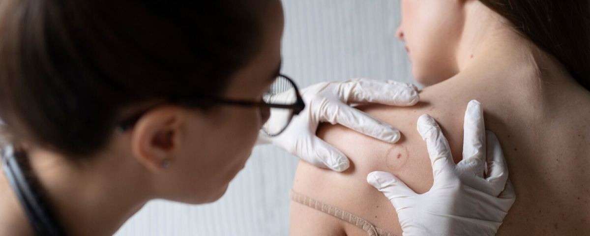 Karen Mora - Dermato - Oncóloga