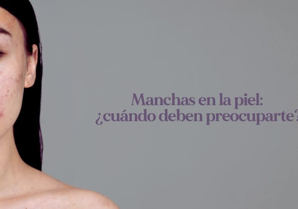 Manchas en la piel