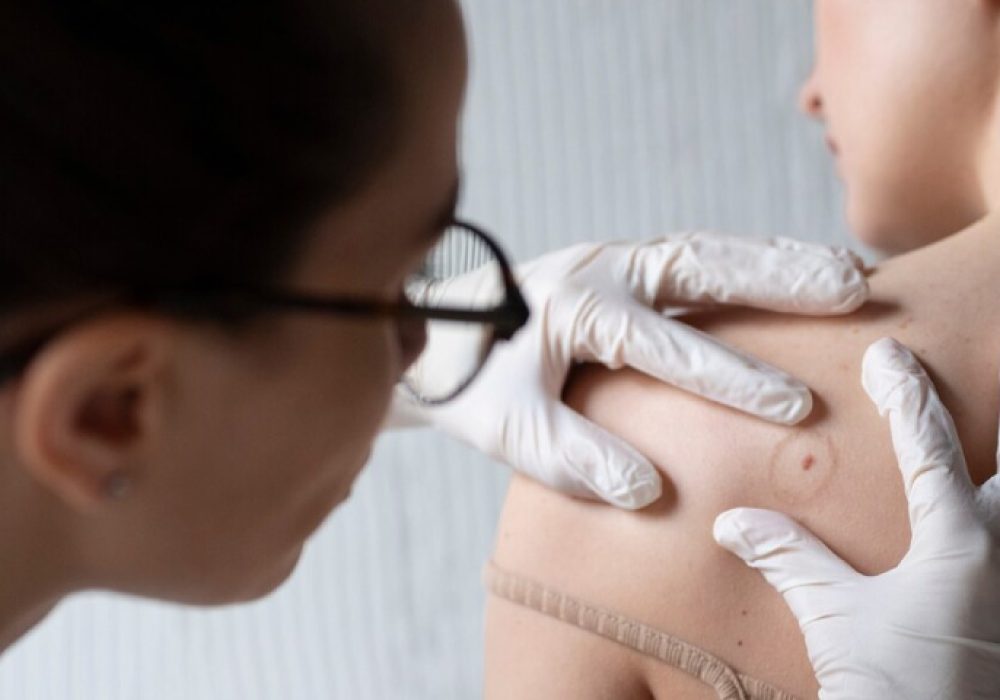 Karen Mora - Dermato - Oncóloga